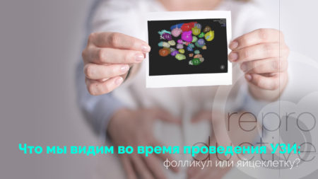 Що ми бачимо під час проведення УЗД: фолікул чи яйцеклітину?
