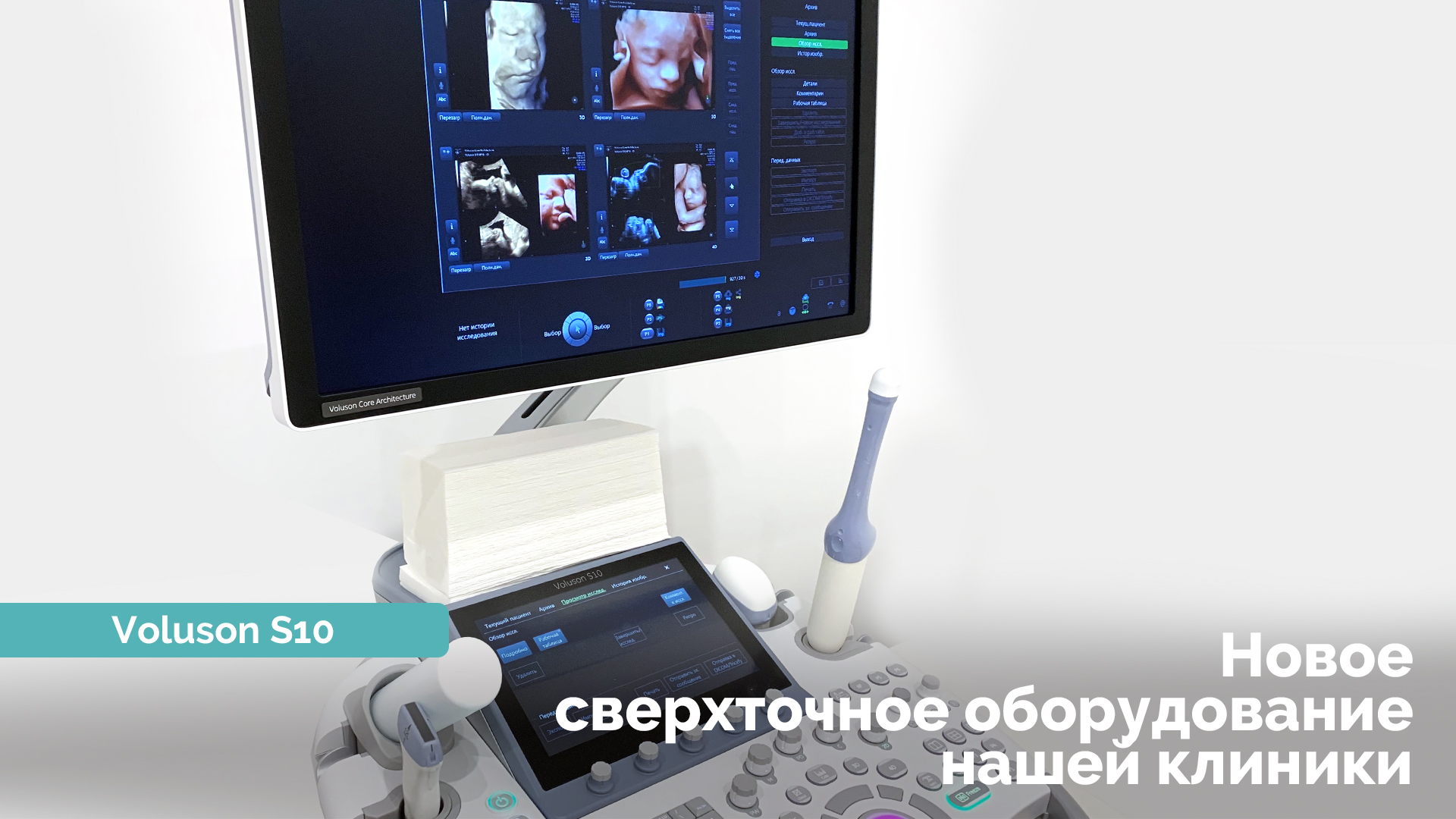 УЗ сканер Voluson S10 - Reprolife
