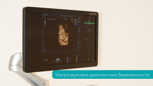 Ультразвуковое исследование беременности