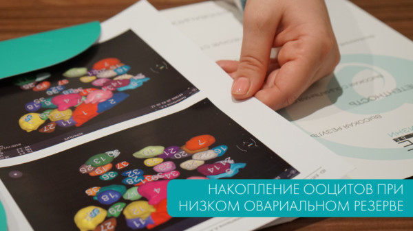 Накопление ооцитов при низком овариальном резерве