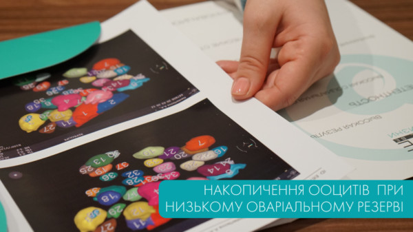 Накопичення ооцитів при низькому оваріальному резерві