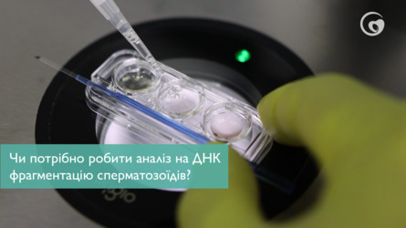 Чи потрібно робити аналіз на ДНК фрагментацію сперматозоїдів?