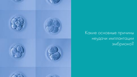 Какие основные причины неудачи имплантации эмбриона?