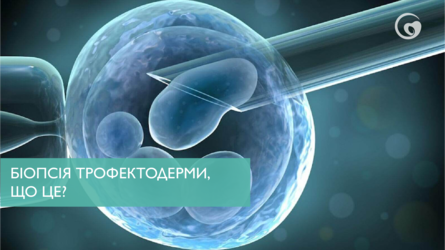 Біопсія трофектодерми, що це?