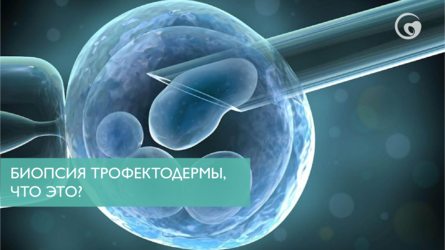 Биопсия трофектодермы, что это?