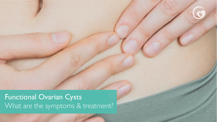 What is a functional ovarian cyst? What are the symptoms and treatment of a functional cyst?