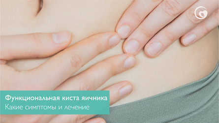 Что такое функциональная киста яичника? Какие симптомы и лечение функциональной кисты?