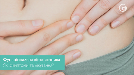 Що таке функціональна кіста яєчника? Які симптоми та лікування функціональної кісти?