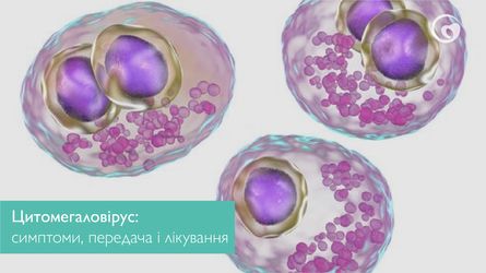 Цитомегаловірус: симптоми, передача і лікування