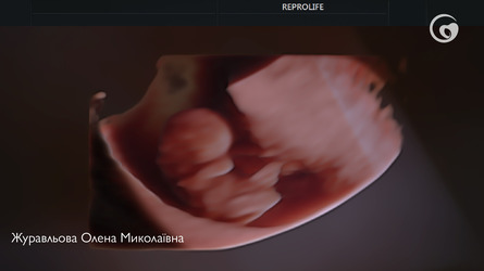Найбільш поширені питання про рухи малюка під час вагітності.