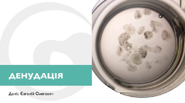 Денудація